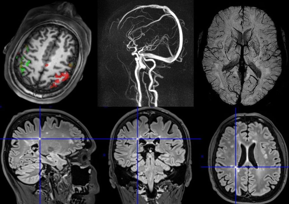 Soubor přednášek o principech i aplikacích magnetické rezonance
