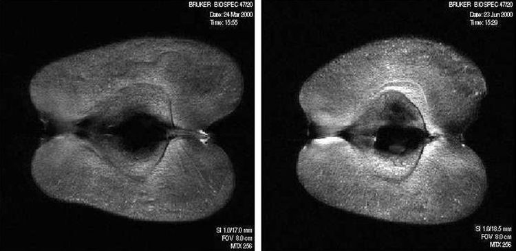 T2-vážené obrazy jablek